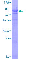 ab160195 on a 12.5% SDS-PAGE stained with Coomassie Blue.