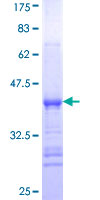ab160196 on a 12.5% SDS-PAGE stained with Coomassie Blue.