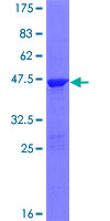 ab165114 on a 12.5% SDS-PAGE stained with Coomassie Blue.