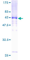 ab158323 on a 12.5% SDS-PAGE stained with Coomassie Blue.