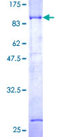 ab158324 on a 12.5% SDS-PAGE stained with Coomassie Blue.