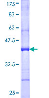 ab158325 on a 12.5% SDS-PAGE stained with Coomassie Blue.