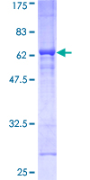 ab158293 on a 12.5% SDS-PAGE stained with Coomassie Blue.