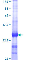 ab158294 on a 12.5% SDS-PAGE stained with Coomassie Blue.