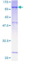 ab158292 on a 12.5% SDS-PAGE stained with Coomassie Blue.