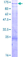 ab161452 on a 12.5% SDS-PAGE stained with Coomassie Blue.
