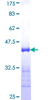 ab161453 on a 12.5% SDS-PAGE stained with Coomassie Blue.