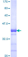 ab160601 on a 12.5% SDS-PAGE stained with Coomassie Blue.