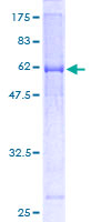 ab153508 on a 12.5% SDS-PAGE stained with Coomassie Blue.