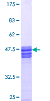 ab152975 on a 12.5% SDS-PAGE stained with Coomassie Blue.