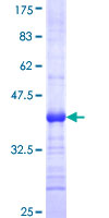 ab163716 on a 12.5% SDS-PAGE stained with Coomassie Blue.