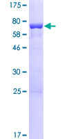 ab164657 on a 12.5% SDS-PAGE stained with Coomassie Blue.