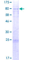 ab166220 on a 12.5% SDS-PAGE stained with Coomassie Blue.