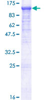 ab161556 on a 12.5% SDS-PAGE stained with Coomassie Blue.
