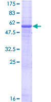 ab164305 on a 12.5% SDS-PAGE stained with Coomassie Blue.