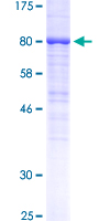 ab158338 on a 12.5% SDS-PAGE stained with Coomassie Blue.