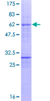 ab161968 on a 12.5% SDS-PAGE stained with Coomassie Blue.