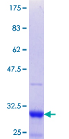 ab161969 on a 12.5% SDS-PAGE stained with Coomassie Blue.