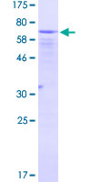 ab160247 on a 12.5% SDS-PAGE stained with Coomassie Blue.