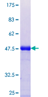 ab160248 on a 12.5% SDS-PAGE stained with Coomassie Blue.