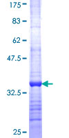 ab152903 on a 12.5% SDS-PAGE stained with Coomassie Blue.