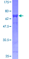 ab152904 on a 12.5% SDS-PAGE stained with Coomassie Blue.