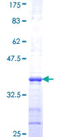 ab152905 on a 12.5% SDS-PAGE stained with Coomassie Blue.