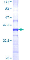 ab158340 on a 12.5% SDS-PAGE stained with Coomassie Blue.