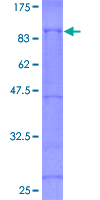 ab158341 on a 12.5% SDS-PAGE stained with Coomassie Blue.