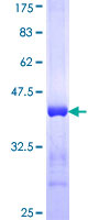 ab160604 on a 12.5% SDS-PAGE stained with Coomassie Blue.