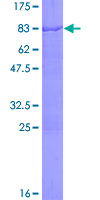 ab153112 on a 12.5% SDS-PAGE stained with Coomassie Blue.