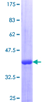 ab153113 on a 12.5% SDS-PAGE stained with Coomassie Blue.