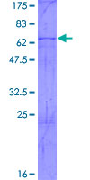 ab158346 on a 12.5% SDS-PAGE stained with Coomassie Blue.