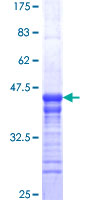 ab158347 on a 12.5% SDS-PAGE stained with Coomassie Blue.