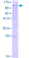 ab158350 on a 12.5% SDS-PAGE stained with Coomassie Blue.