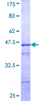 ab158351 on a 12.5% SDS-PAGE stained with Coomassie Blue.