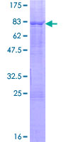 ab158353 on a 12.5% SDS-PAGE stained with Coomassie Blue.