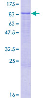 ab164104 on a 12.5% SDS-PAGE stained with Coomassie Blue.
