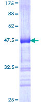 ab159645 on a 12.5% SDS-PAGE stained with Coomassie Blue.