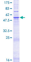 ab162883 on a 12.5% SDS-PAGE stained with Coomassie Blue.