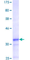 ab161960 on a 12.5% SDS-PAGE stained with Coomassie Blue.