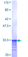 ab165395 on a 12.5% SDS-PAGE stained with Coomassie Blue.