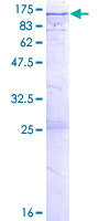 ab158354 on a 12.5% SDS-PAGE stained with Coomassie Blue.