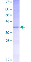 ab158358 on a 12.5% SDS-PAGE stained with Coomassie Blue.
