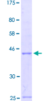 ab158360 on a 12.5% SDS-PAGE stained with Coomassie Blue.