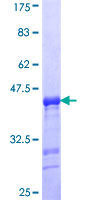 ab160831 on a 12.5% SDS-PAGE stained with Coomassie Blue.