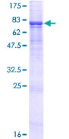 ab161519 on a 12.5% SDS-PAGE stained with Coomassie Blue.