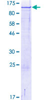 ab162341 on a 12.5% SDS-PAGE stained with Coomassie Blue.