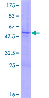 ab158332 on a 12.5% SDS-PAGE stained with Coomassie Blue.