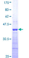 ab158333 on a 12.5% SDS-PAGE stained with Coomassie Blue.